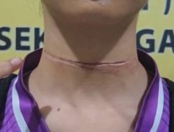 Wanita di Nanga Pinoh Alami Luka Bagian Leher Terjerat Tali Layangan di Jembatan Melawi 1